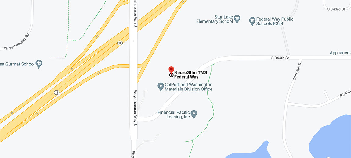 Federal Way Office neurostim-transcranial-magnetic-stimulation-clinic-federal-way-auburn-washington